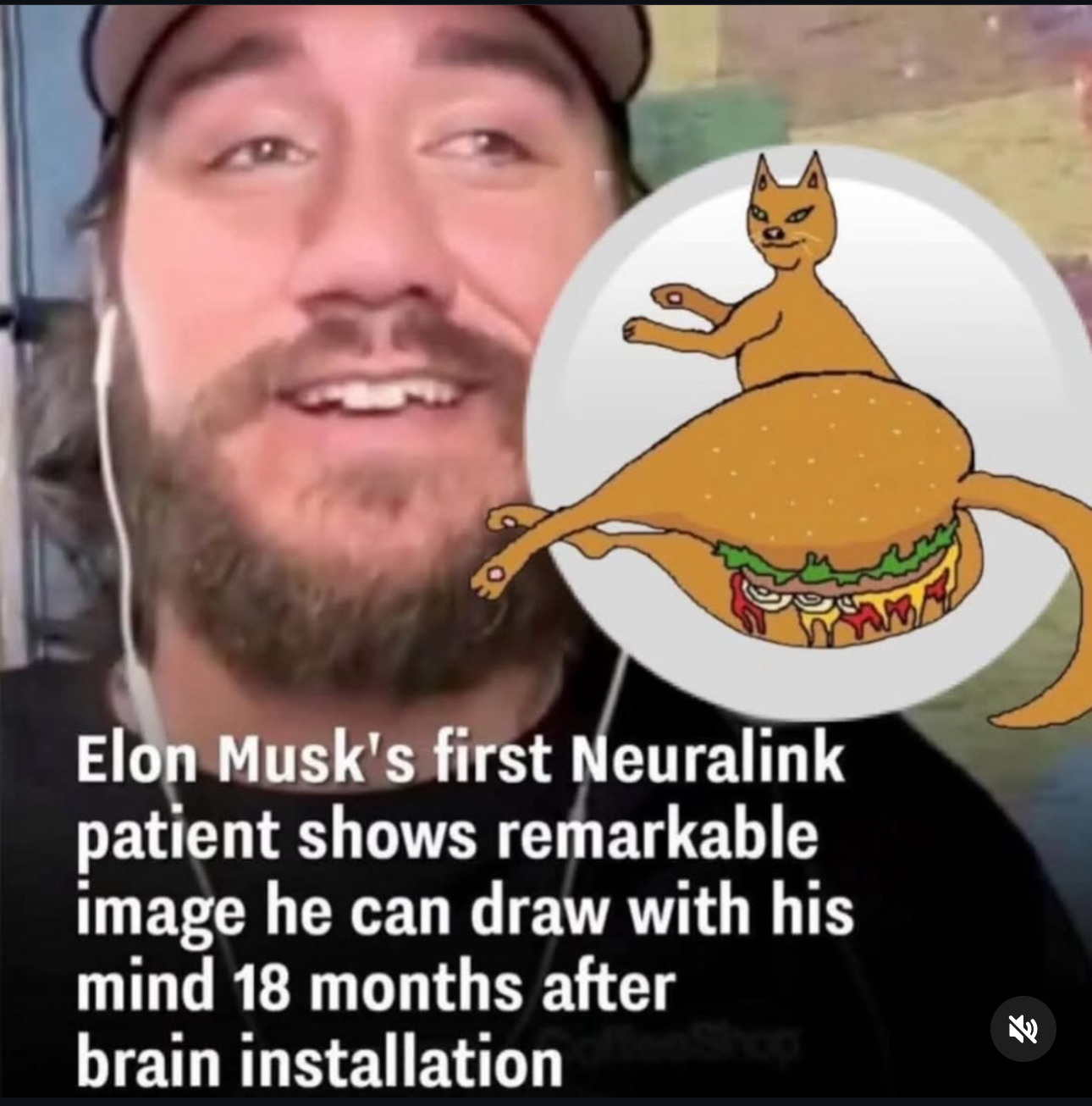 Neuralink Patient